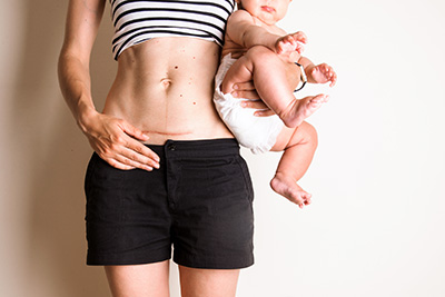 Maternity szülés utáni regeneráló torna
